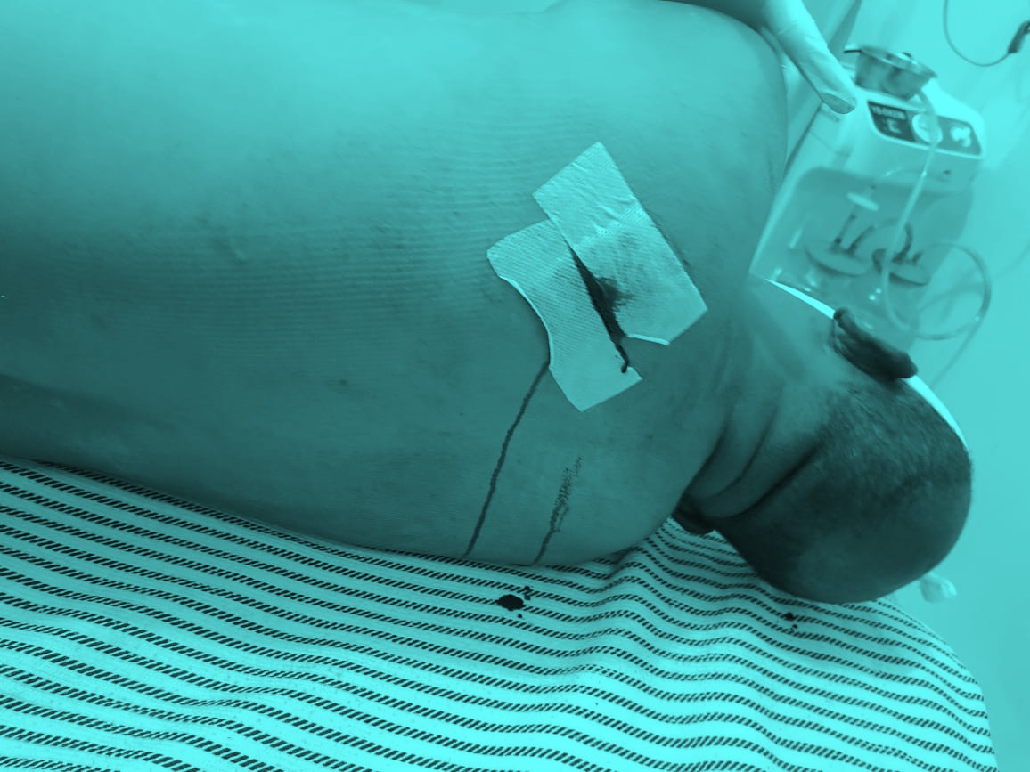 Apel Dirumah Kekasih, Karyawan HKI Tewas Diujung Belati