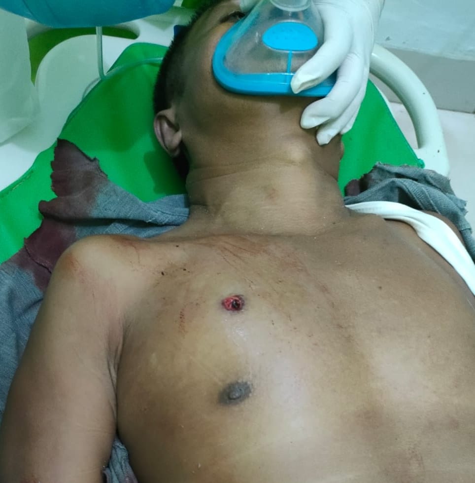 Mantan Anggota DPRD Langkat Tewas Ditembak OTK, Begini Kronologinya