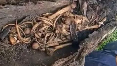 5 Fakta Penemuan Kerangka Manusia di Dalam Pohon Aren di Sergai