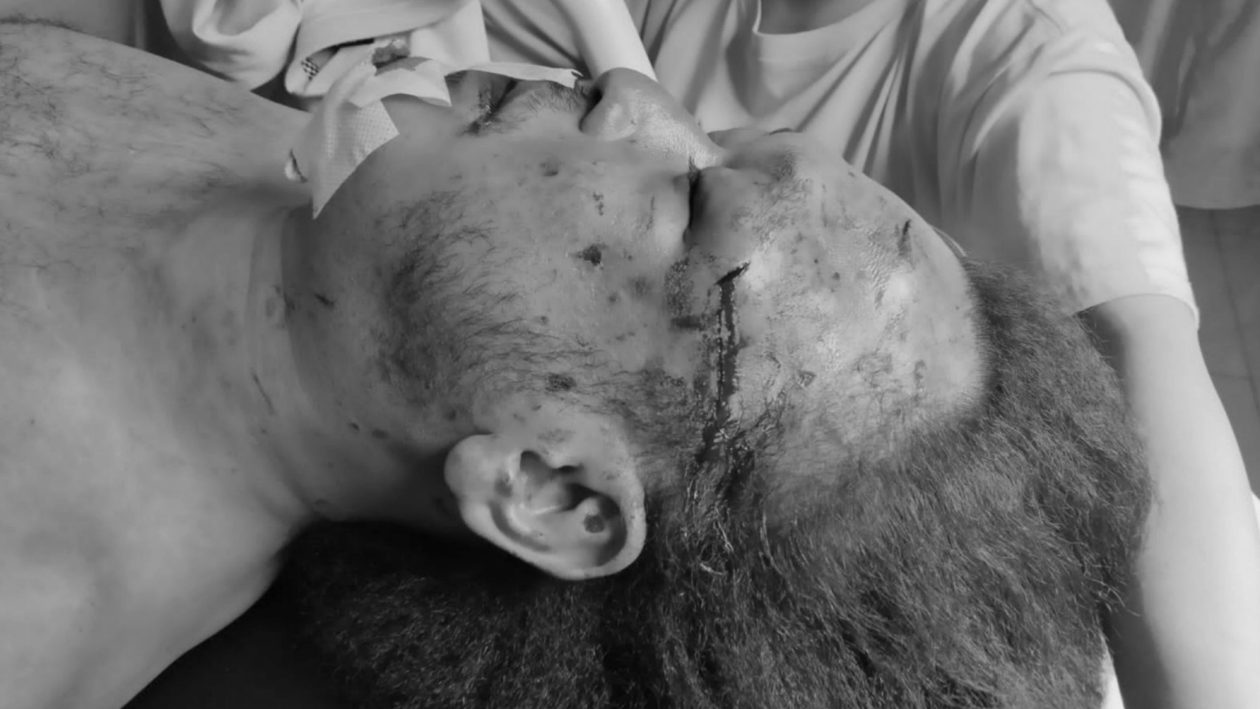 Tubuh Banyak Luka, Nico Wartawan Medan Diduga Tewas Dianiaya